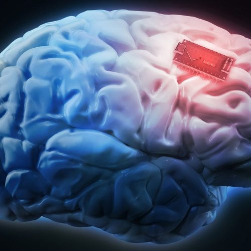 تراشه مغزی ایلان ماسک