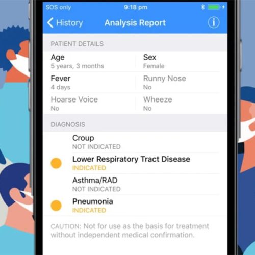تشخیص کرونا کووید 19
