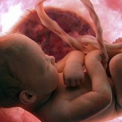 جنین مصنوعی